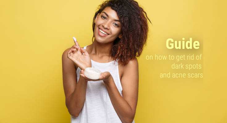 Guide on how to get rid of dark spots and acne scars