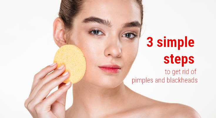 3 simple steps to get rid of pimples and blackheads